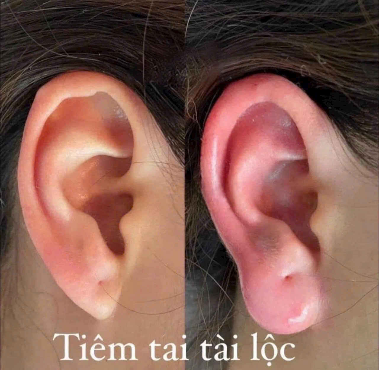 Tai tài lộc
